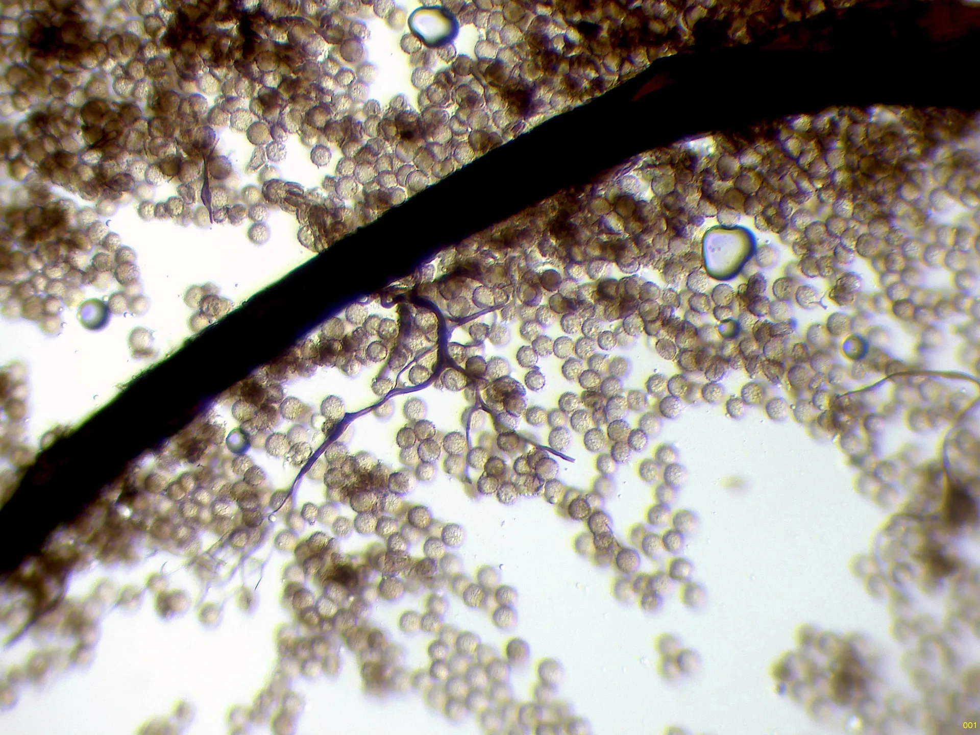 Microscopía de Stemonitis marjana - 12 - Capilicio x 400 agua-001